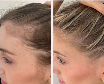 Red Light Therapy Scalp Massager