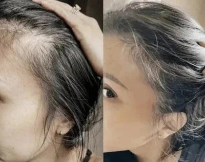 Red Light Therapy Scalp Massager