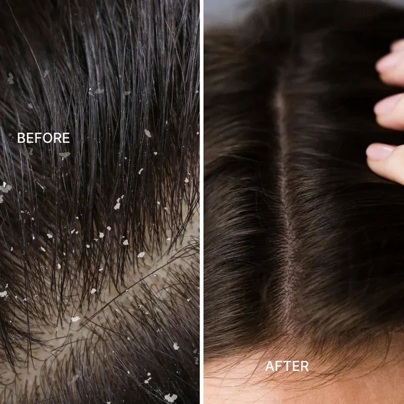 Red Light Therapy Scalp Massager