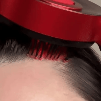 Red Light Therapy Scalp Massager
