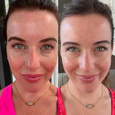 EMS Micro-Current Eye Massager